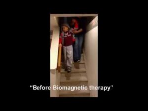 Jane’s story with biomagnetism